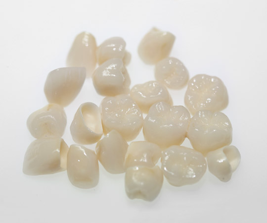 Vollkeramische Versorgung Dr. Andre Müller Zahnarzt in Leutenbach-Nellmersbach Vollkeramische Versorgung Dr. Andre Müller Zahnarzt in Leutenbach-Nellmersbach